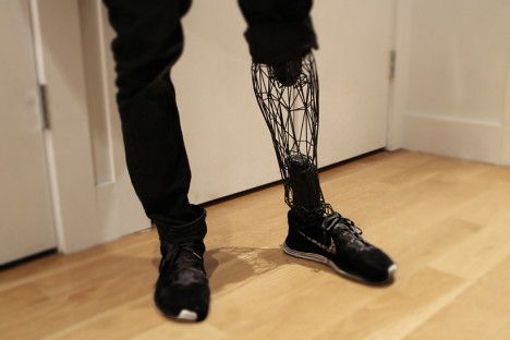 3d modeled exo prosthetic
